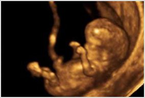 A picture of an image that is blurry.